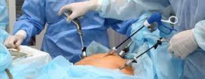 Read more about the article The Importance of Laparoscopic Surgery