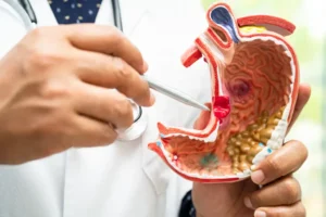 Read more about the article How Gallbladder Stones Can Affect Your Energy Levels