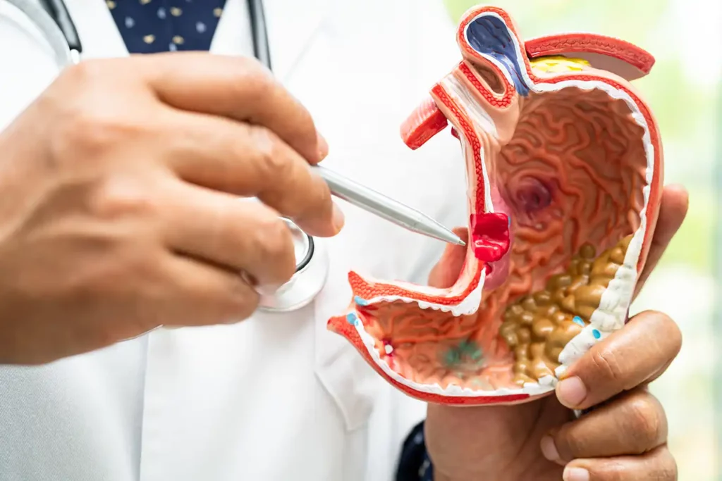 You are currently viewing How Gallbladder Stones Can Affect Your Energy Levels
