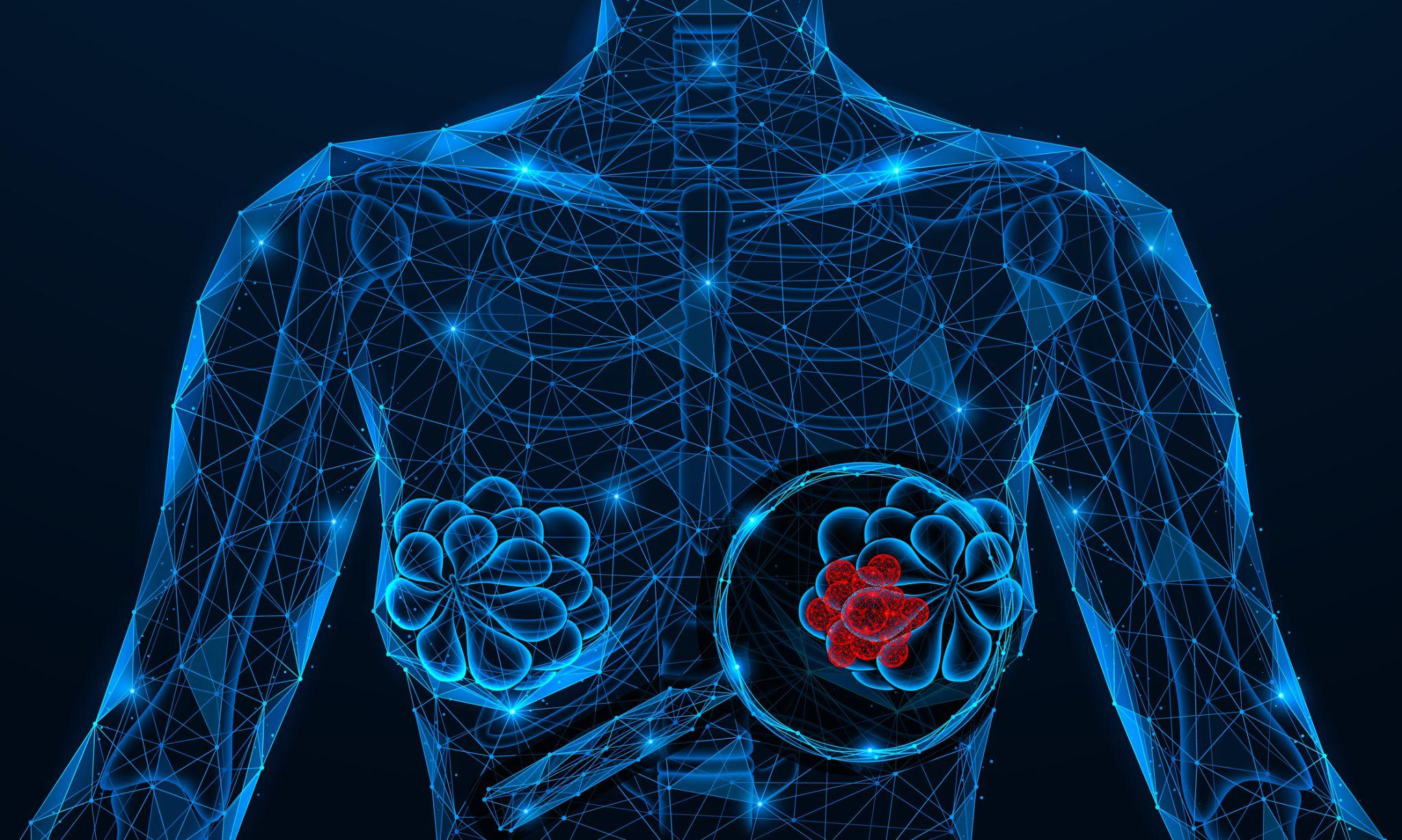 You are currently viewing Early Signs of Breast Cancer Every Woman Should Know