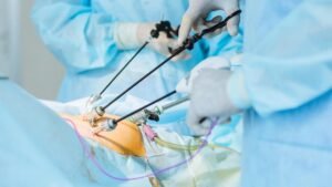 Read more about the article How to Choose the Right Gallbladder Specialist in Kolkata for Gallstone Surgery